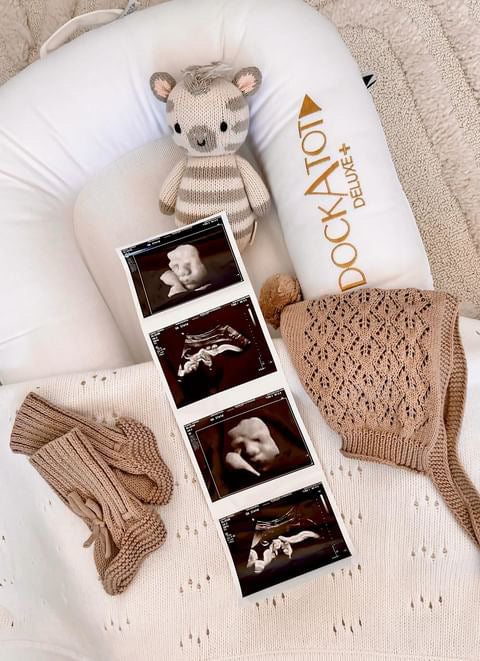 Ultrasound Pregnancy Announcement Photo Strips