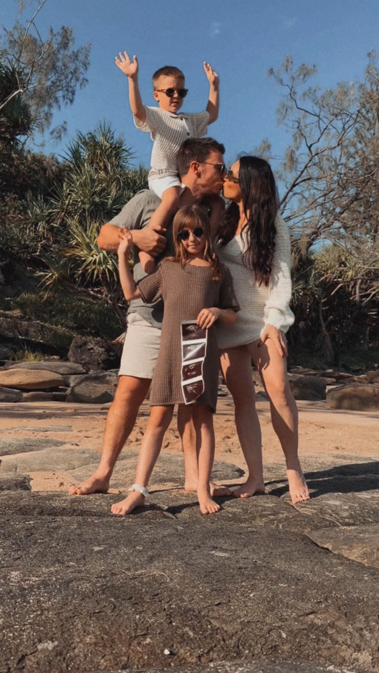 Ultrasound Pregnancy Announcement Photo Strips