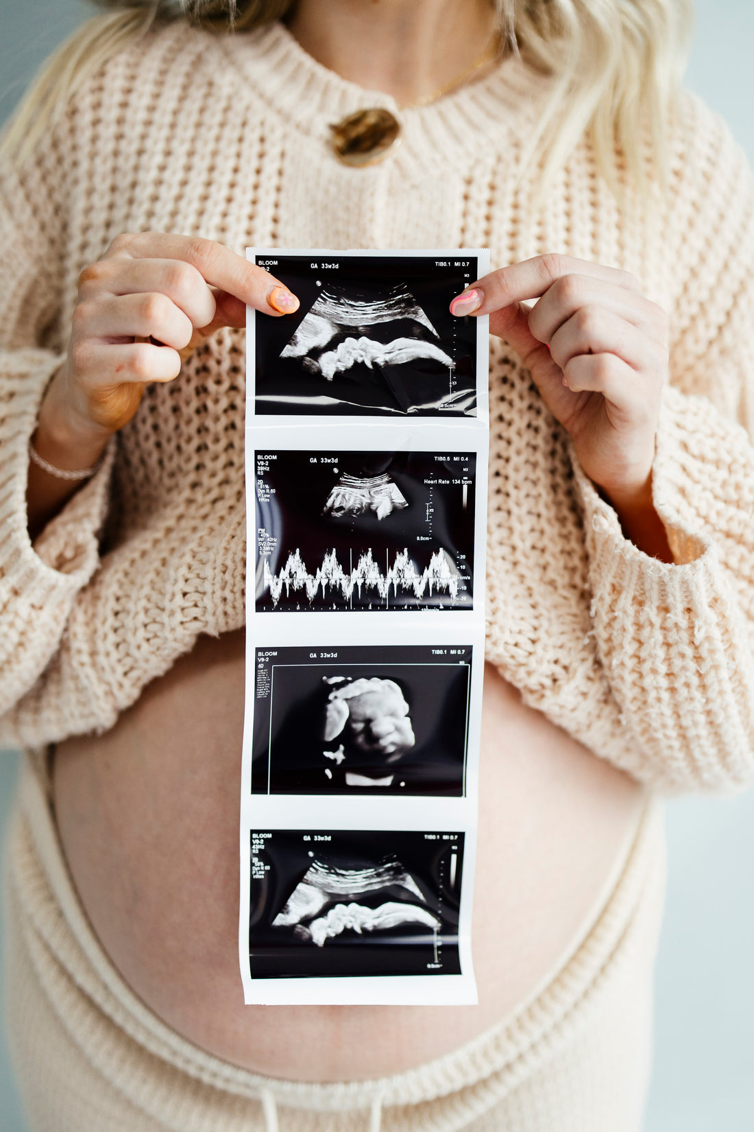 Ultrasound Pregnancy Announcement Photo Strips