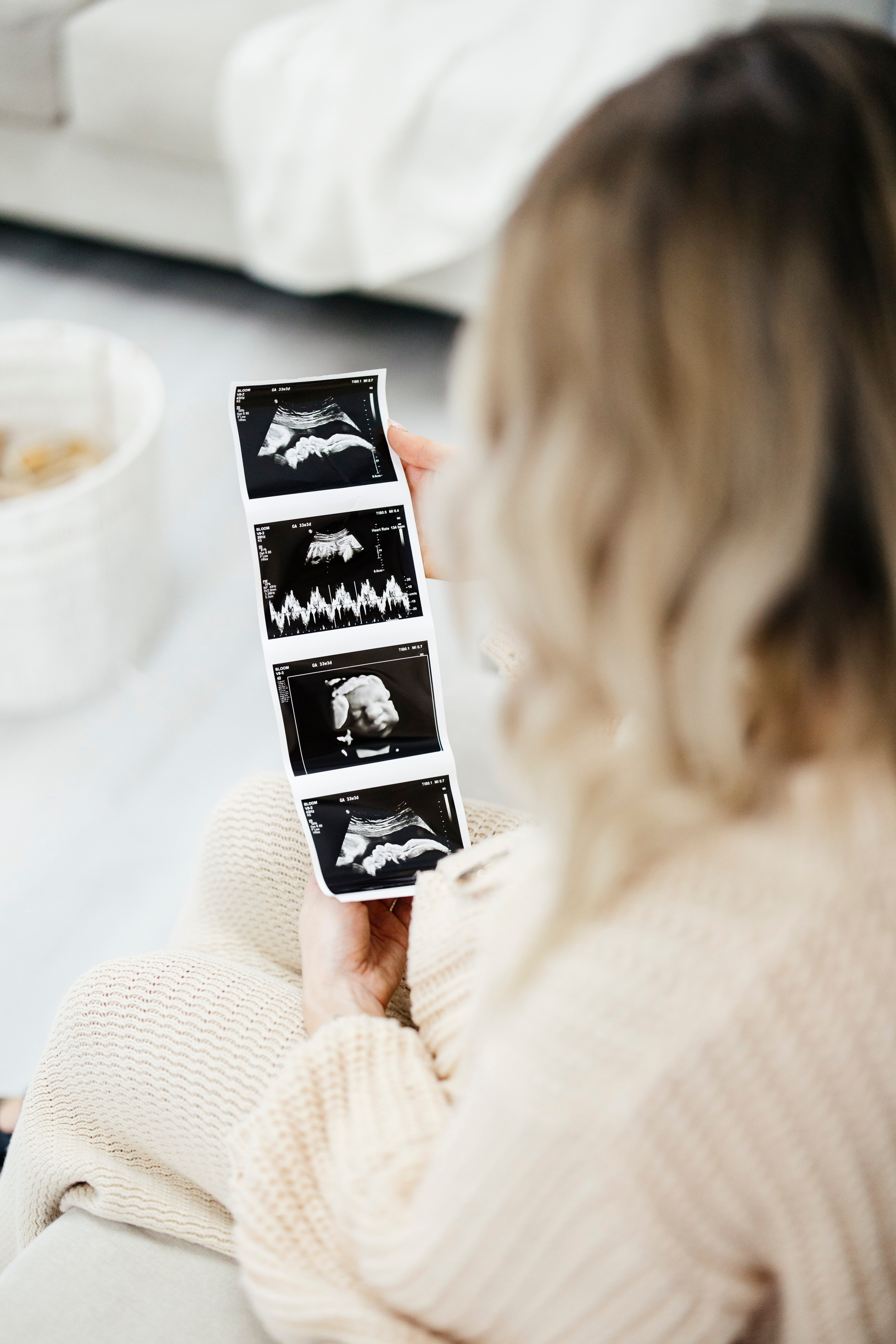 Ultrasound Pregnancy Announcement Photo Strips