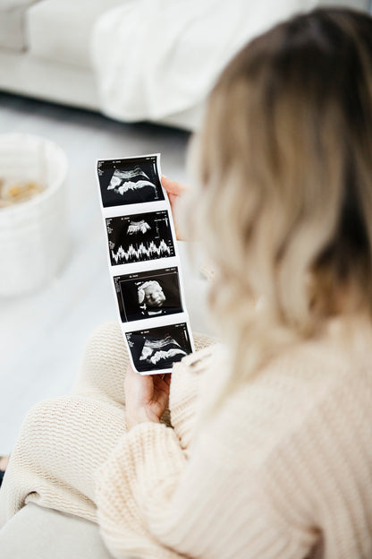 Ultrasound Pregnancy Announcement Photo Strips